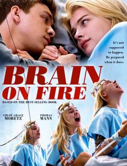    / Brain on Fire (2016) HD 720 (RU, ENG)